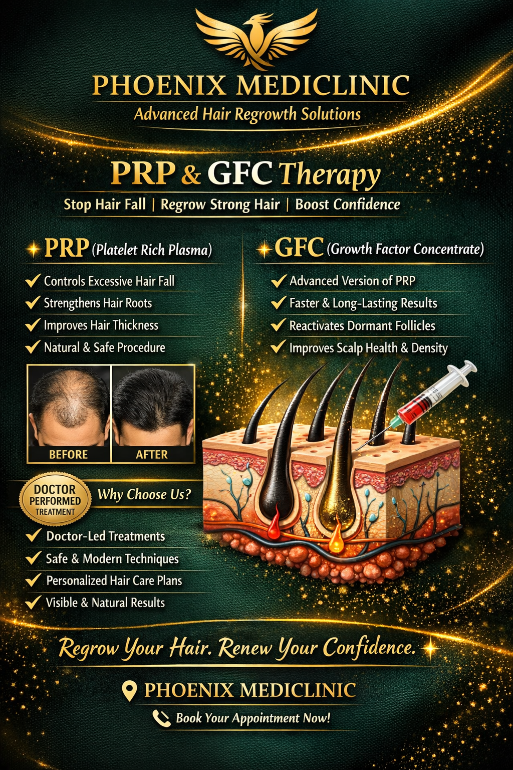 PRP and GFC Hair Treatment